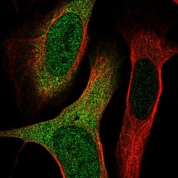 SH3TC2 Antibody, Novus Biologicals 25 &mu;L, Unlabeled:Antibodies, Polyclonal